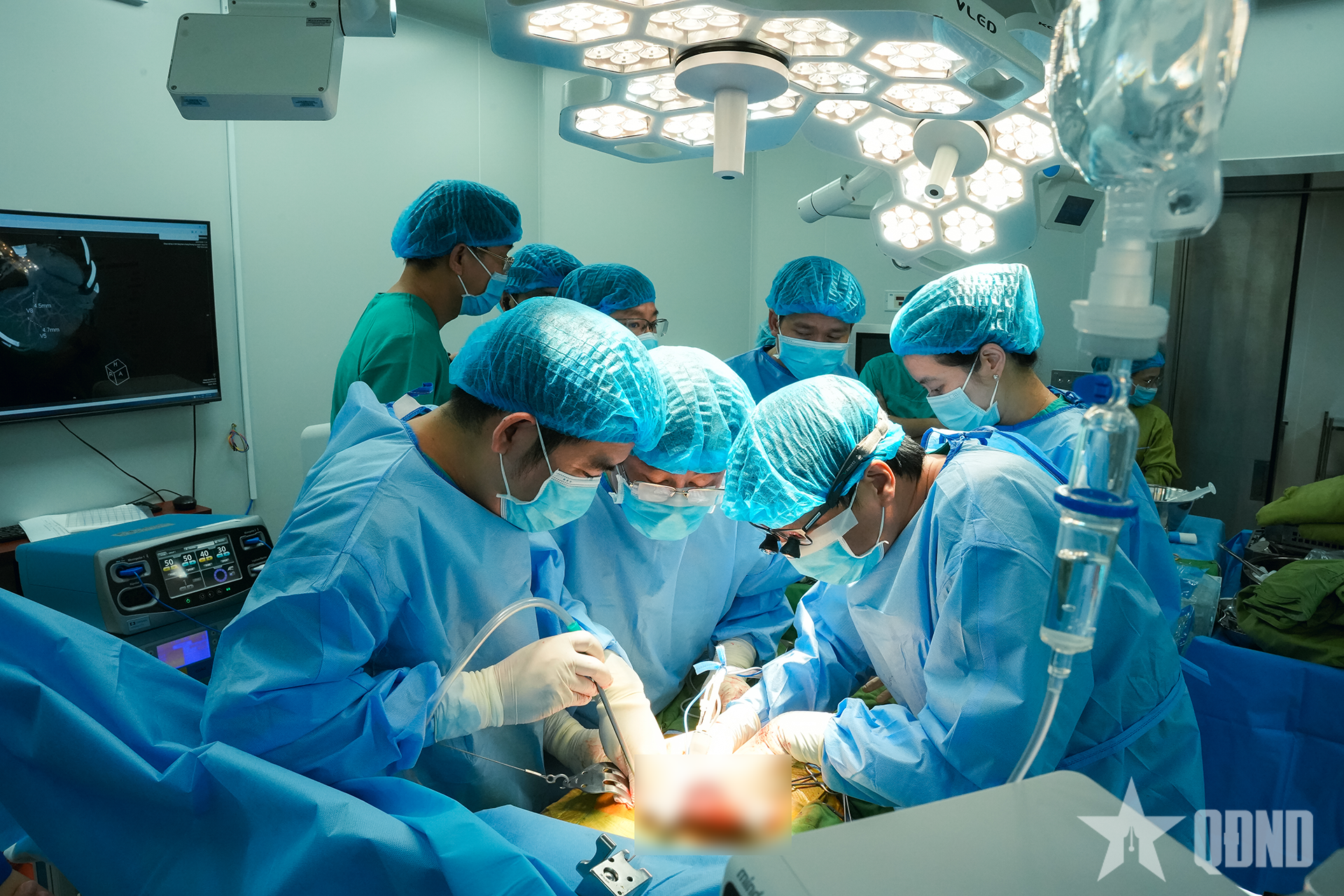 Bệnh viện Thống Nhất phối hợp thực hiện thành công ca ghép gan từ người hiến sống đầu tiên